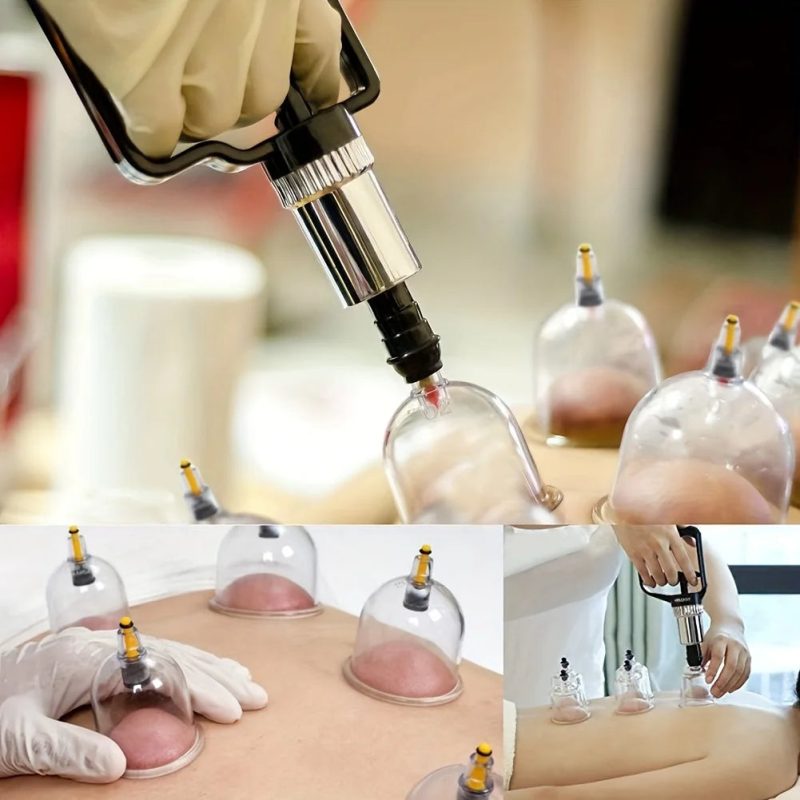 32-Piece Cupping Therapy Set – Vacuum Massage Kit with Hand Pump - Image 2
