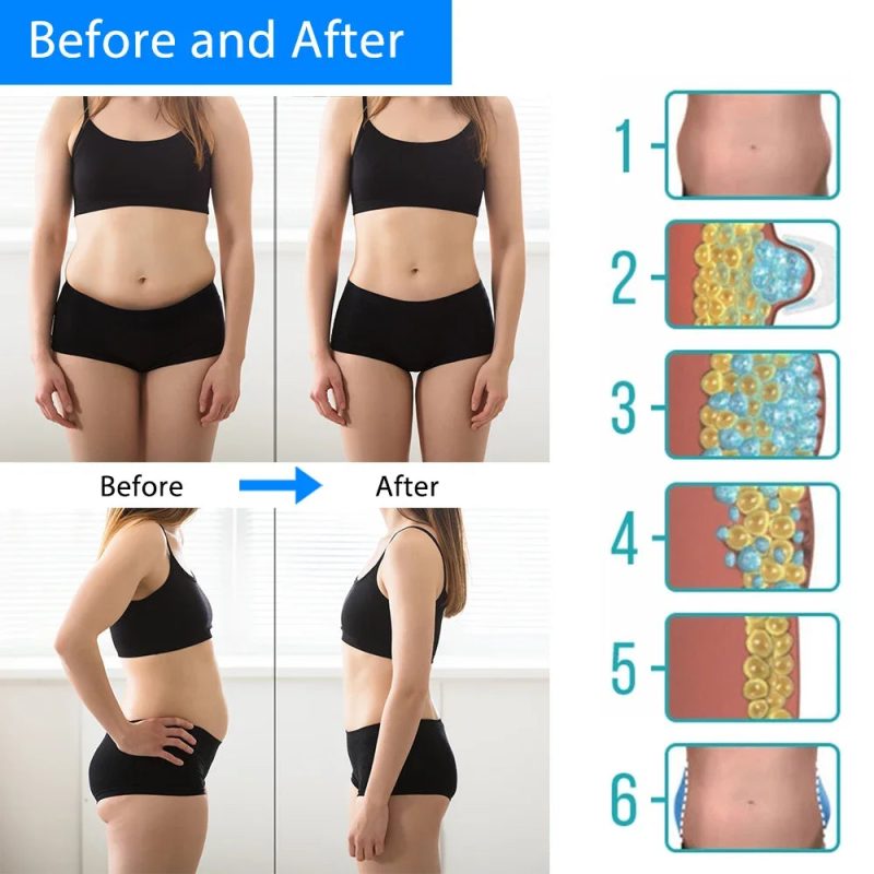 Cryotherapy Fat Freezing Machine – Cold Therapy Slimming & Anti-Cellulite Massager - Image 5